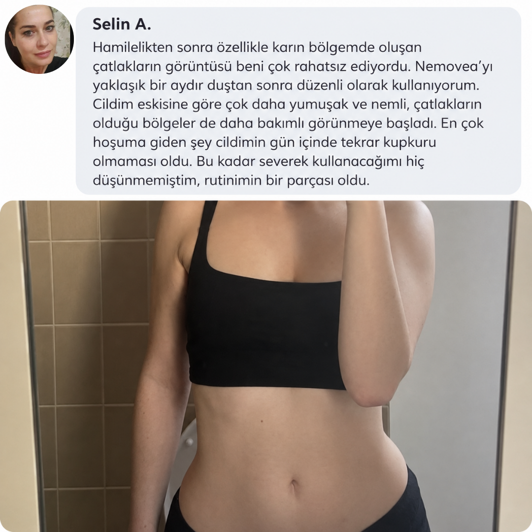 Müşteri deneyimi