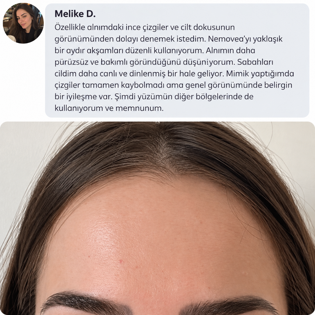 Müşteri deneyimi